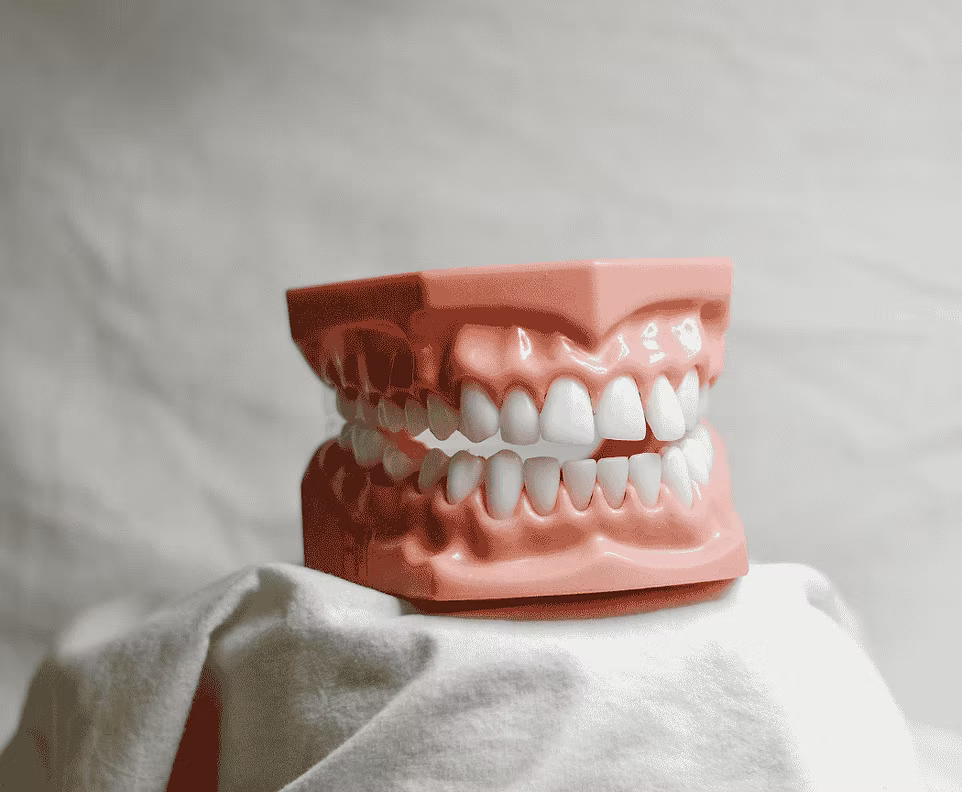 Dental model showing full set of upper and lower teeth